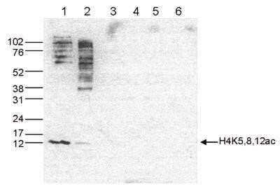 Western Blot: Histone H4 [ac Lys5, ac Lys8, ac Lys12] Antibody [NBP2-59252]